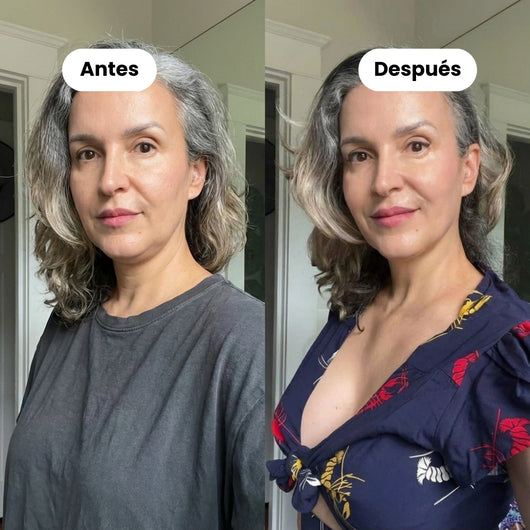 Banda Facial Sculpt de Colágeno (Compra 1 y Llévate 1 Gratis)