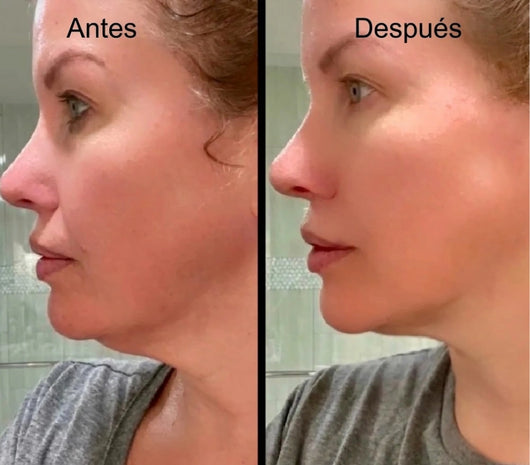 Cepillo Facial Linfático Skulpt