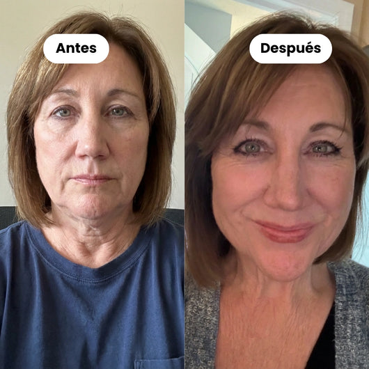 Banda Facial Sculpt de Colágeno (Compra 1 y Llévate 1 Gratis)