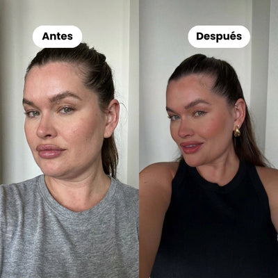 Banda Facial Sculpt de Colágeno (Compra 1 y Llévate 1 Gratis)