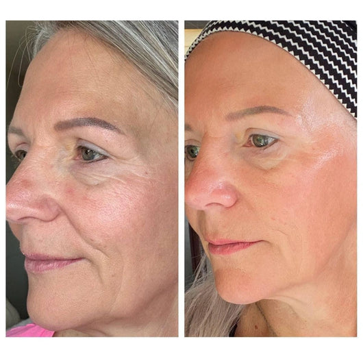 Cepillo Facial Linfático Skulpt